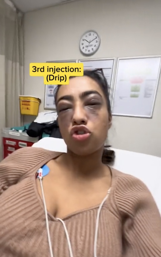 Sewlal seemed unbothered by the whole ordeal as she received adrenaline injections in her thigh and arm as well as an intravenous drip and continued to record the contents.